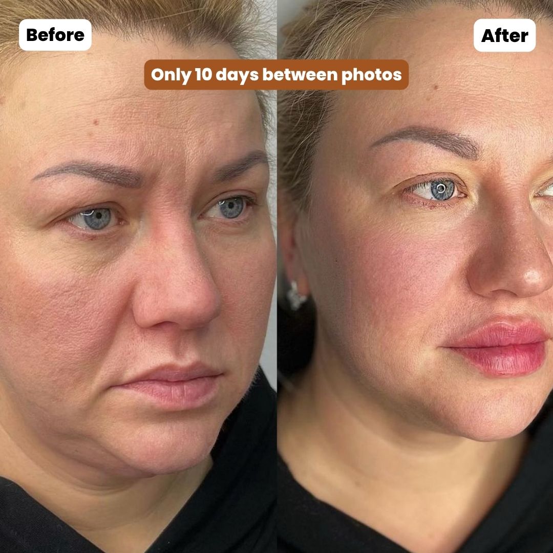 Seleva™ Lymphatic Contour Face Brush